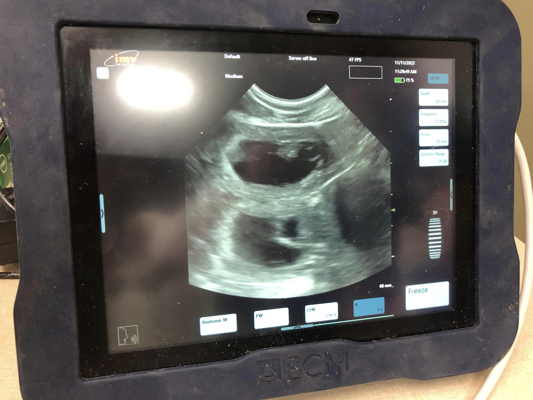 Stormy/Gunner Ultrasound Confirmation